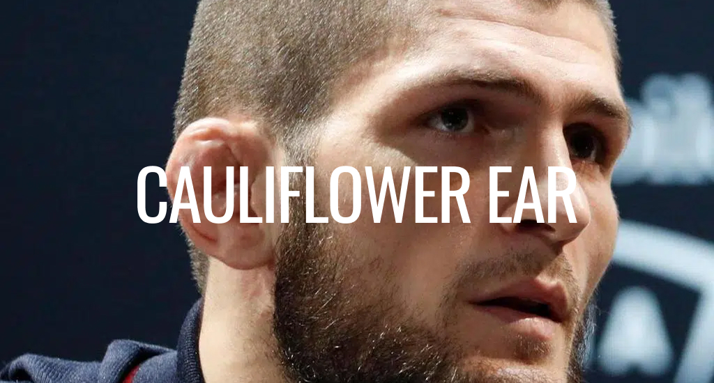 Is Cauliflower Ear Dangerous? An Honest Safety Guide